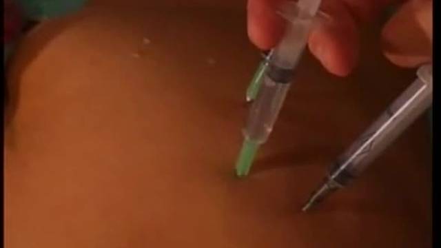 Injection - Injection videos | YourPorn Tube